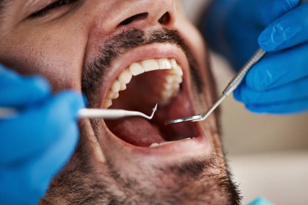 Best Emergency Dental Care for Trauma or Injury in Ellis, KS